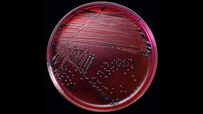 Salmonella on an agar plate.