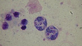 Fynd av Martelia refringens, två stora runda celler med flera mindre intracellulära utvecklingsstadier, så kallade tertiärceller.