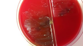 Odling av Helcococcus på agar