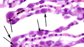 Mikroskopbild av epiteliocystis.