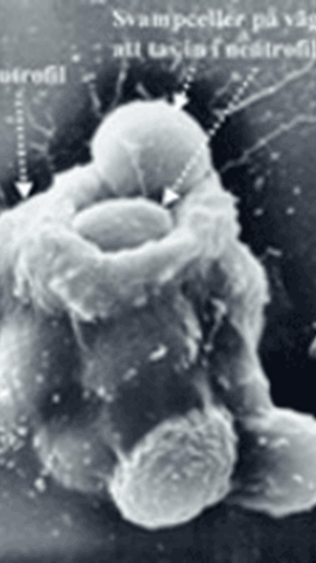 Neutrofil fagocyterande bakterie