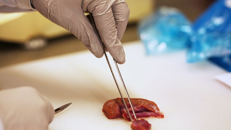 Trikinlarverna ska separeras från vävnaden, 5 gram används i första testet.