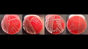Fyra agarplattor med bakterieodling