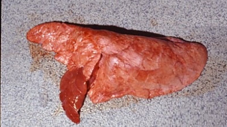 Bild av enzootisk pneumoni, SEP, hos gris