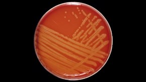 Agarplatta med bakteriekultur