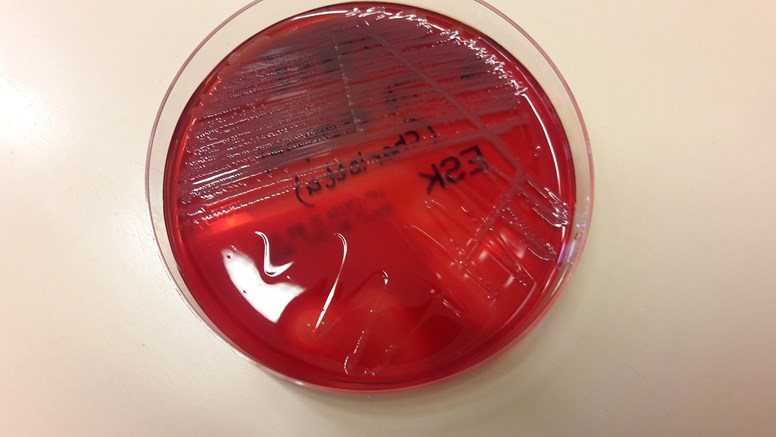 Blodagarplatta med bakterieodling
